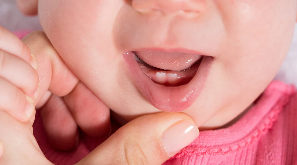 bebeklerde-diş-çıkarma